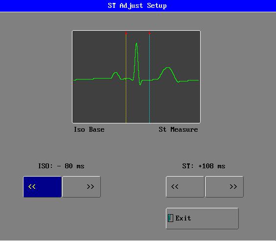 ST SEGMENT MONITORING OPERATON SEQUENCE Click the button of in the ECG setup ST Analysis menu to pop up the ST setup menu.