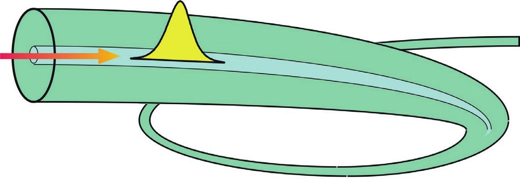 Backscattering occurs when a photon encounters an impurity inside the fiber core. This causes the light to be sent backwards into the fiber in the direction of the light source (Fig. 3).