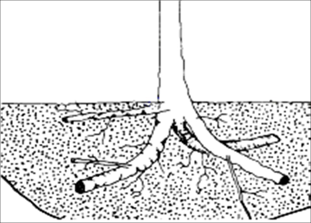 Root collar location Top most root Root flare Remove soil or media around the base of the trunk until