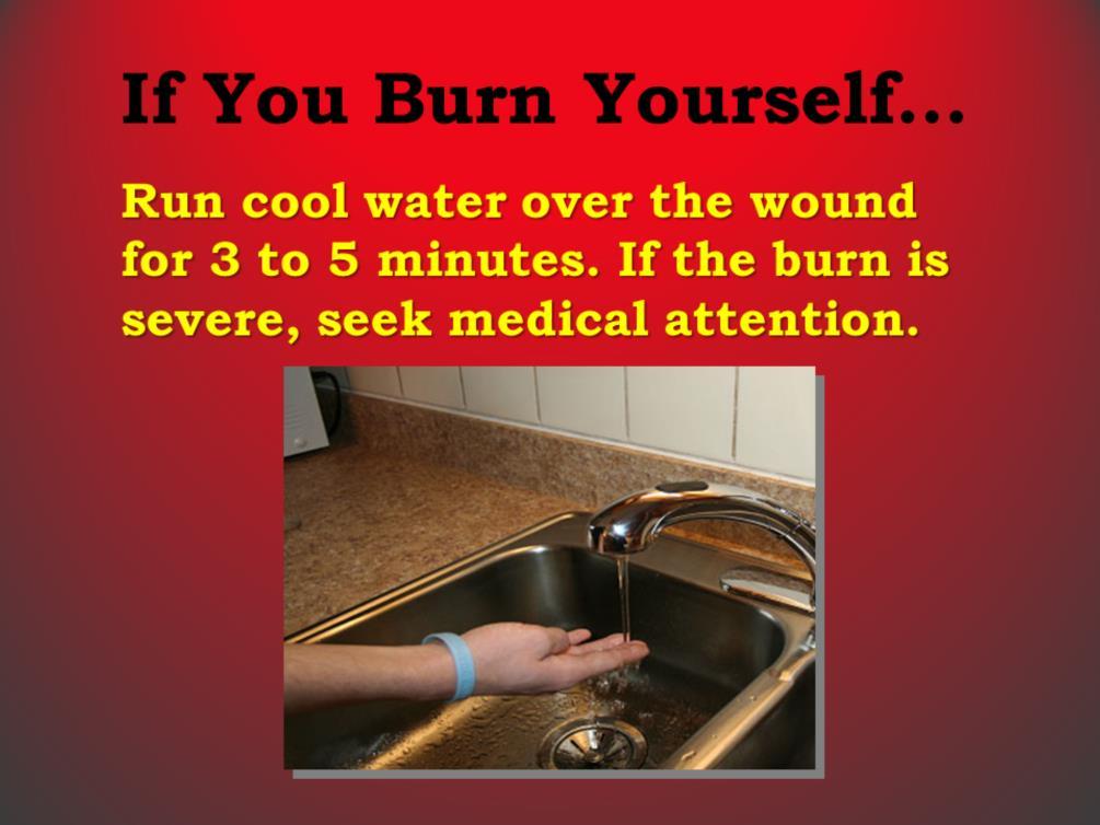 Q: What should you do if you burn yourself? A: Cool the burn under cool water.