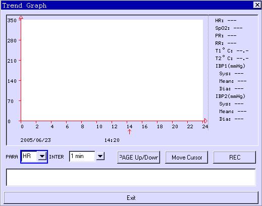Fig. 4-2-11: Display of trend graph multiple-parameter monitor can store 96 hours trend data.