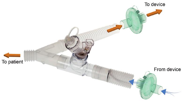 ResMed recommends Aerogen nebuliser products designed to operate in-line with standard ventilator circuits and mechanical ventilators without changing ventilator parameters or interrupting