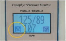 8.5 The PRE-ZERO USED alert on the LCD display indicates that the BPM is connected to a PSS that was previously properly zeroed and in service - but the PSS became disconnected or the BPM power was