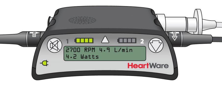 3.0 Handling HeartWare HVAD System Components 3.1 How the Controller Works Controller Connections There are four ports on the controller.