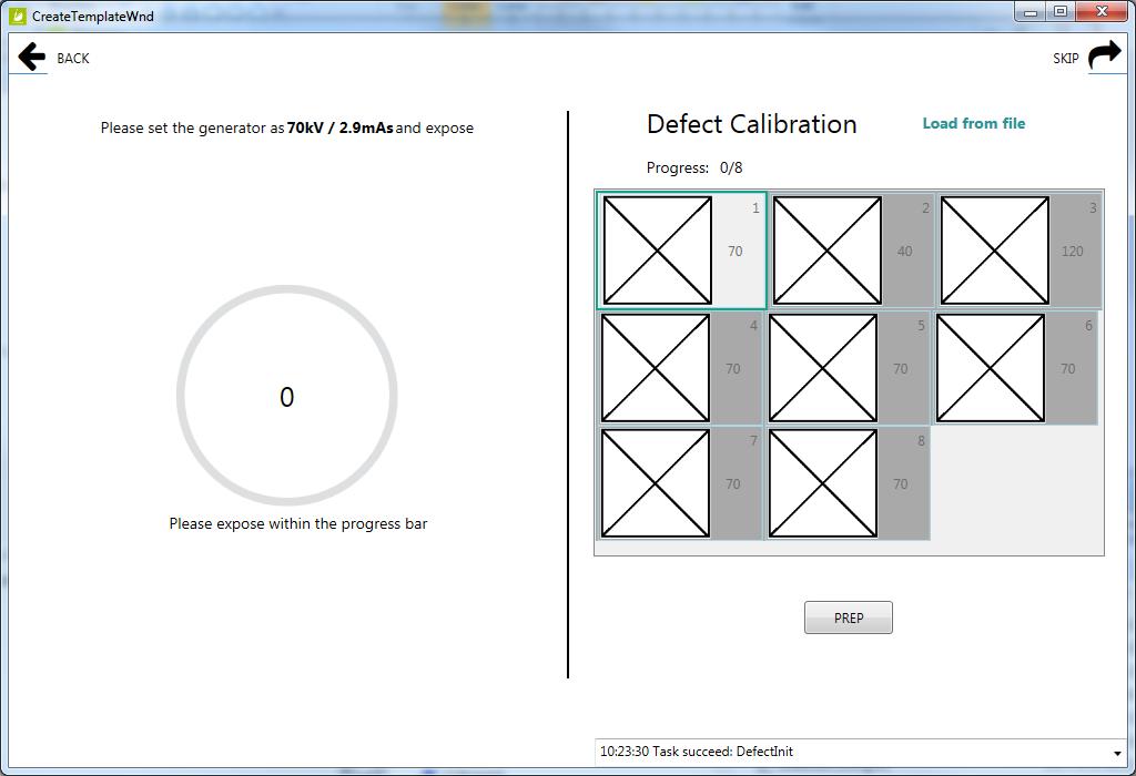 Venu1012X Digital Flat Panel Detector User Manual 4. Click PREP button. 5. Exposure and acquire images.