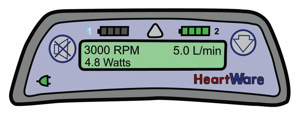 HeartWare Display Battery Indicator 1 Battery Indicator 2 Power Source 1 Alarm