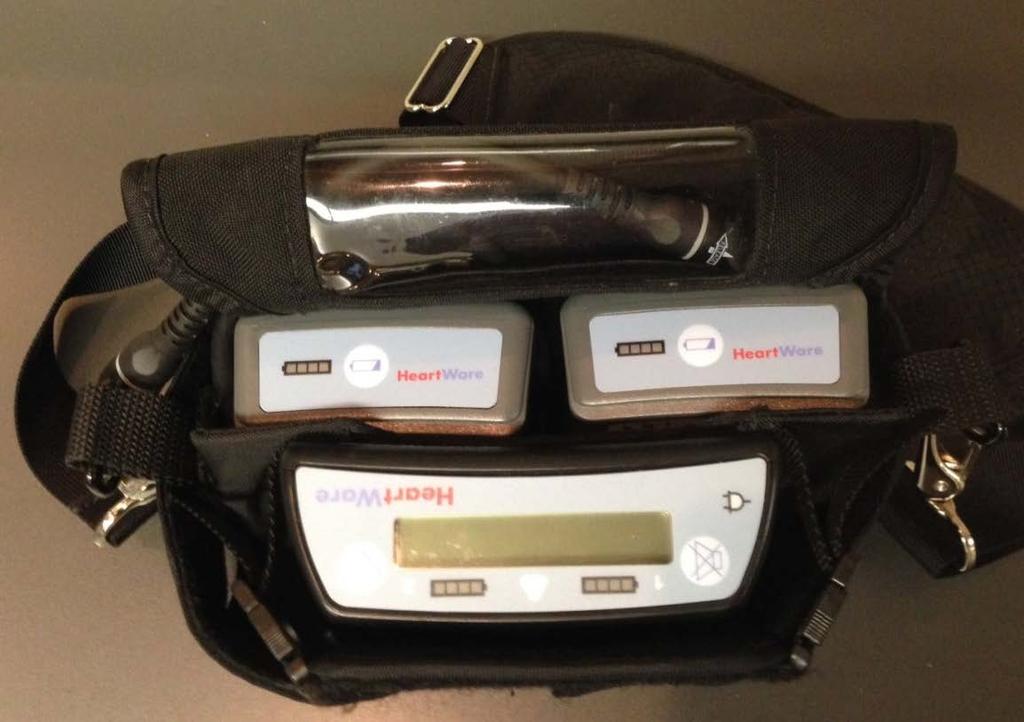 batteries in carrying bag Ensure