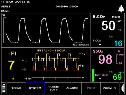 Upper and lower alarm limits for etco 2, SpO 2, and Integrated Pulmonary Index Algorithm (IPI) are now displayed. Example: k.