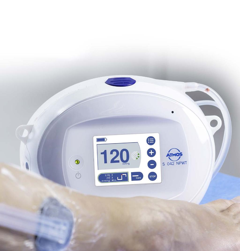 Wound Drainage Vacuum therapy uses controlled negative pressure to support and accelerate wound healing, improved blood circulation and granulation of new tissue.