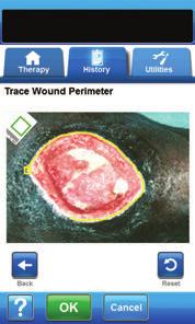 Analyzing Images - Trace Wound Perimeter 1.