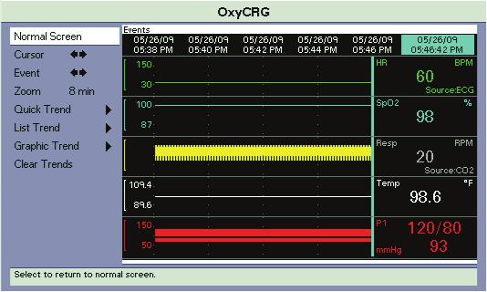 Trends OxyCRG 15.5 OxyCRG The OxyCRG function is available for neonatal patients only.