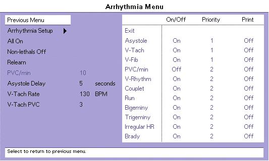 Arrhythmia Analysis (Optional) ECG Monitoring 4.8 Arrhythmia Analysis (Optional) NOTE: WARNING: Arrhythmia analysis is available for Adult and Pediatric patients only.