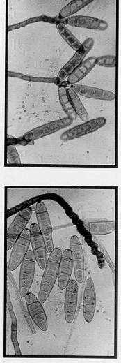 1989. Fungal disease of amenity turf grasses. E & F.N.