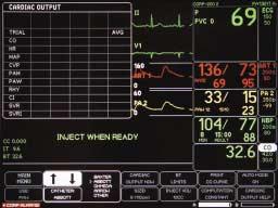 Cardiac Output The Cardiac Output Program measures cardiac output by use of a thermodilution catheter.