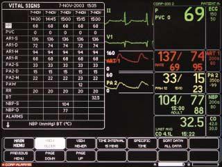 Patient Data Vital Signs: Provides 24 hours of stored parameter data. In addition, the last 20 cardiac calculations and the last 10 pulmonary calculations are stored.