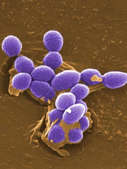 Enterococcus as the Fecal Indicator Bacteria Fecal indicator bacteria (FIB) Predictive of the potential for human infectious disease Enterococcus: FIB for marine waters Found in guts of