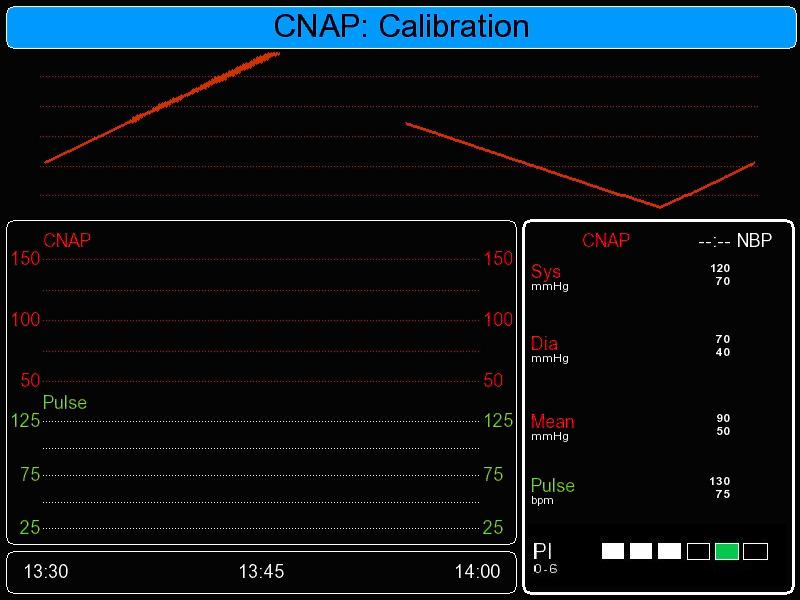 Monitor configuration CAUTION: In order to ensure full accuracy of the CNAP blood pressure waveform and its derived blood pressure values to another patient monitor, do not forget to perform an IBP