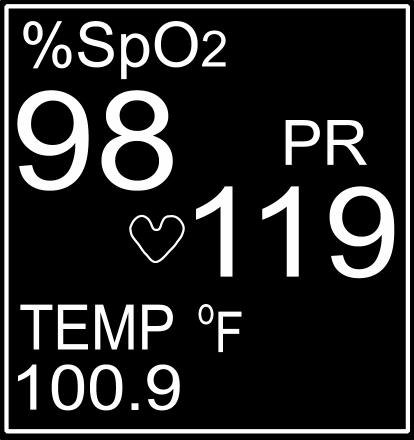 NUMERIC AND TEMPERATURE Figure 16: Numerics and Temperature In the models 9403 and 9405, this section displays the numeric values for %SpO 2 and Pulse Rate and a flashing visual icon for the