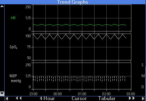 TREND GRAPHS Trend Graphs Trend Graphs display up to 12 hours of trended data at a time, sampled and updated every minute.