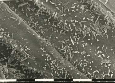 Arrow points at a micro-colony (detail of Fig. 1). (Photo by Anke Clerkx). Fig. 3.