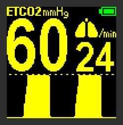 ETCO 2 values are displayed after one breath and the averaged value is updated every breath. 5.2.2 Respiratory Rate Respiratory Rate (RR) is displayed as breaths per minute (3-150 bpm).