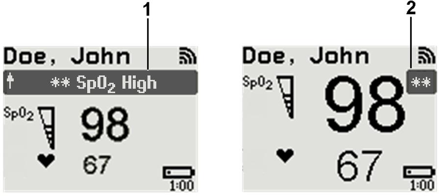 2 IntelliVue CL SpO2 Pod Alarm Layout If an alarm occurs the full alarm message appears at the top of the screen.