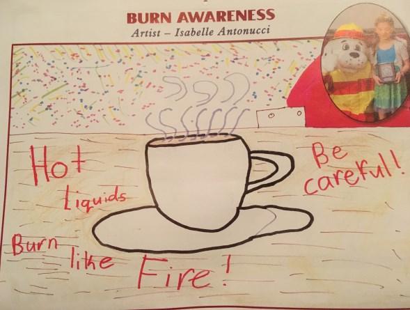 JA N / F E B S a f e t y E d u c ato r FEBRUARY: BURN AWARENESS by: Isabelle