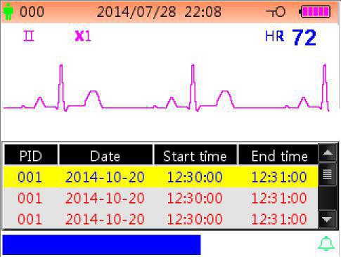 26 Figure 4.4 ECG waveform recall screen ECG waveform displaying area: II: ECG lead. X1: waveform gain. HR 72: heart rate mark and the measured heart rate.