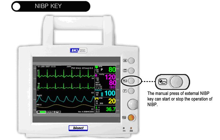 8.2 NIBP Data Window Alarm Limit:Indicates alarm limit of blood pressure. Measurement time Indicates the completion time of measuring mmhg 150 60 ADT 09:30 1 H.
