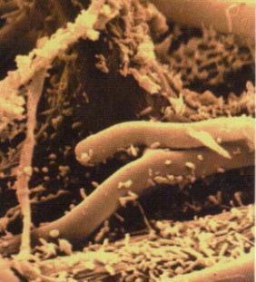 earthworm & soil