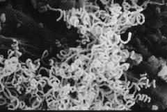 Actinomycetes are a type of bacteria that have fungi like characteristics including their thread-like structure.