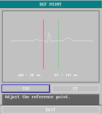 ECG/RESP Monitoring Figure 12-9 DEF POINT window The operator can adjust the position of both ISO and ST measurement points. The reference point is the position where the peak of R-wave locates.