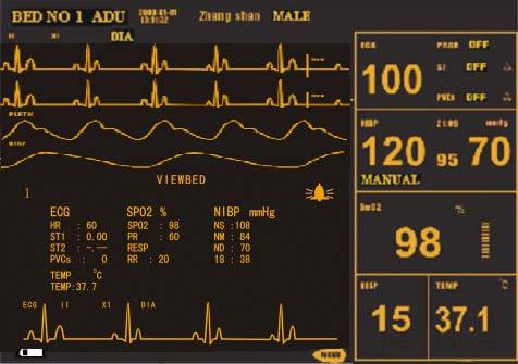 System Menu Figure 3-8 STANDARD SCREEN Viewbed Screen: If another monitor is connected on the same LAN of this monitor, you can use this monitor to view any measured waveform and information about