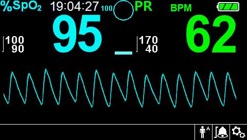 Standard Monitoring Sweep Speed Overview Allows the clinician to set the speed to where the SpO 2 waveform trace moves across the screen.