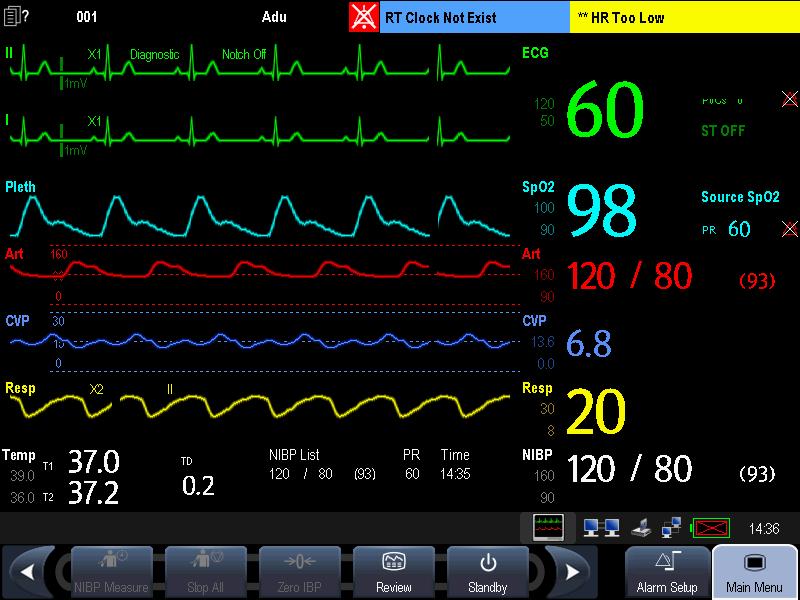2.5 Display Screen This patient monitor adopts a high-resolution TFT LCD to display patient parameters and waveforms. A typical display screen is shown below. 1 2 3 4 5 6 7 8 9 1.
