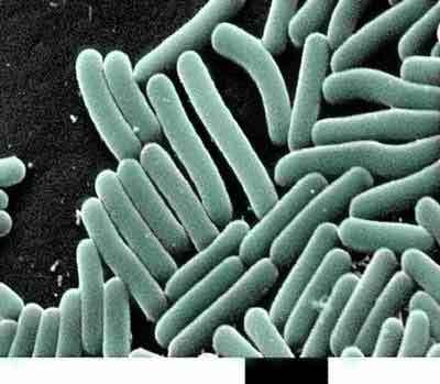 Bacteria & Fungi in ¼ tsp of