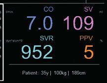 NAVIGATION 22 FUNCTION OF NAVIGATION FRAMES Signal & Trend View Selector Hemodynamic frame > switch between signal view and parameter trends > activating/ deactivating HD > manual entry or change of