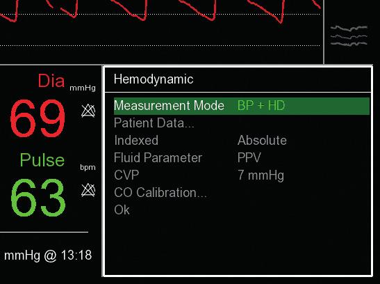 3. ENABLING HEMODYNAMIC PARAMETERS FOR A MEASUREMENT 1 If HD is not enabled, hemodynamic frame shows question marks: select with click-wheel -