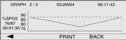 OxiMax Sensor Event Record The PRINT softkey allows the user to print the displayed event graph. The BACK softkey takes the user back to the previous TREND/SENSOR sub-menu level.