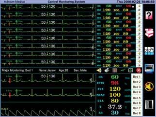 In real time the Omniview displays the patient s numeric vital signs along with waveforms.