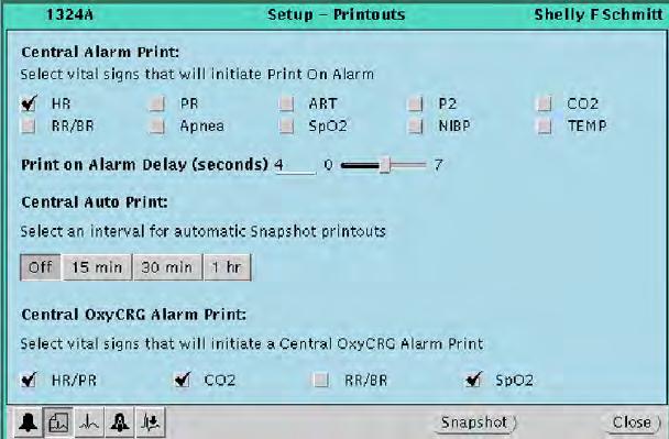 Directions for use Chapter 4 Adjust monitoring settings and patient information 49 Adjust preferences for a patient s central station printouts This section presents the Printouts Setup window, in