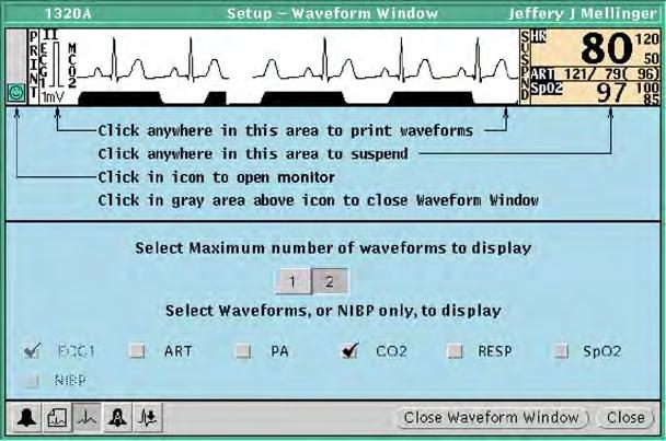 Directions for use Chapter 4 Adjust monitoring settings and patient information 51 Adjust a patient s waveform displays You can select waveforms for display in a patient s Virtual Monitor and