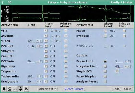 Directions for use Chapter 4 Adjust monitoring settings and patient information 65 To initiate relearn of a patient s ECG rhythm for arrhythmia and ST-segment analyses The relearn operation cannot be