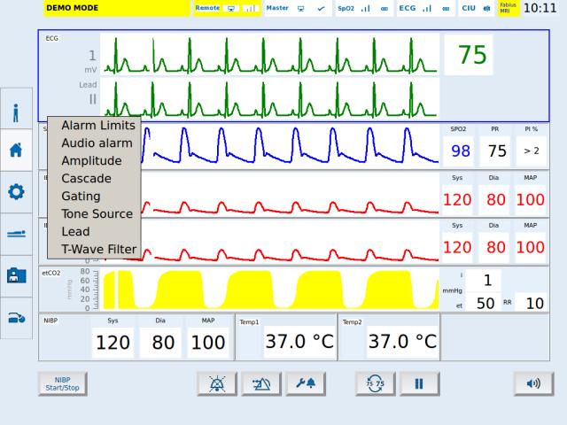 5.6.3. The ECG menu All relevant settings concerning the ECG may be changed in the ECG menu.