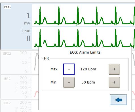 5.6.4. Setting the alarm limits Press the alarm limits bar in the ECG menu. In the sub menu Alarm limits you can change the upper and lower heart rate limit by pressing the +/- icons.