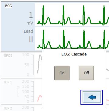 7. ECG Cascade mode The ECG curve in the upper parameter box displays ECG data of approximately 10 seconds. In cascade mode the ECG is continued in the second ECG parameter box.