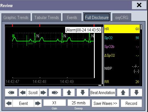 You can set the desired [Gain] for ECG waveform. You can set the desired [Sweep]. By selecting the [Record] button, you can print the displayed alarm events with the recorder.