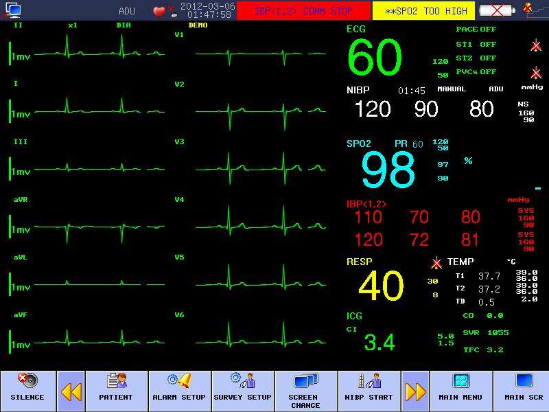 ECG-CardioTec TM : 12-lead ECG Analysis CardioTec TM technology 12- lead ECG waveform synchronously display high precision ECG measurement technology, provides professional diagnosis assistance