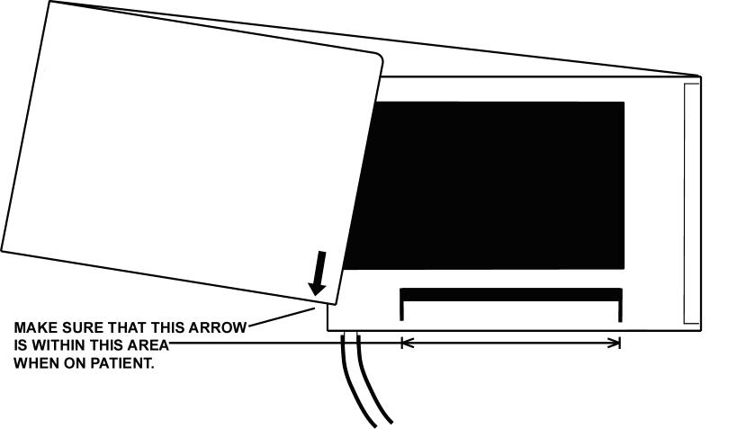 Figure 50: Cuff Application Proper cuff application is essential. The end of the cuff is marked with an arrow.