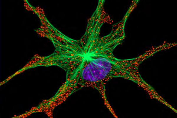 Applications Confocal Microscopy Wide variety of applications in cell / tissue